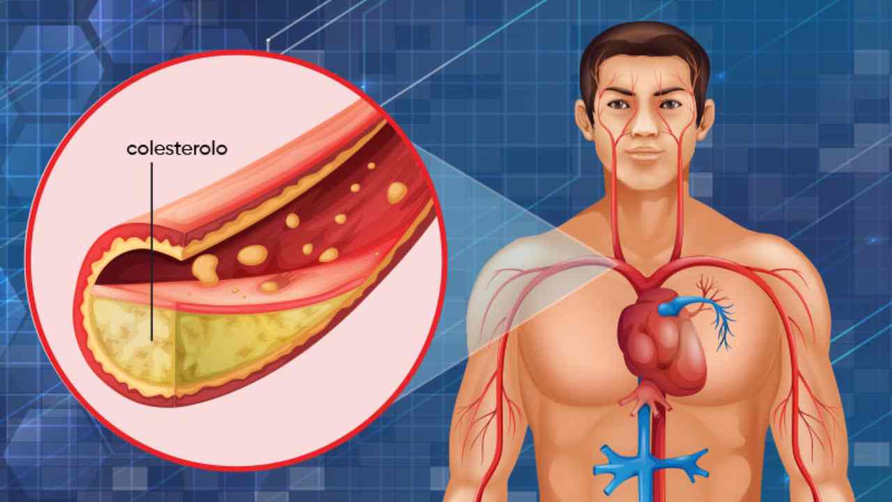 Colesterolo alto (fonte web)