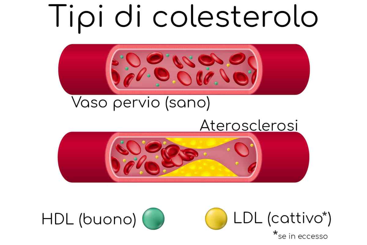 Colesterolo-Crmag.it