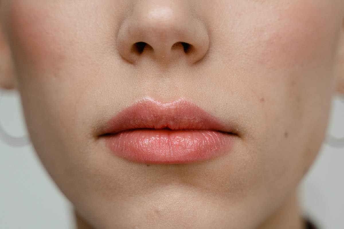 Soffri di labbra secche? Il rimedio ce l'hai in casa: bastano 5 minuti