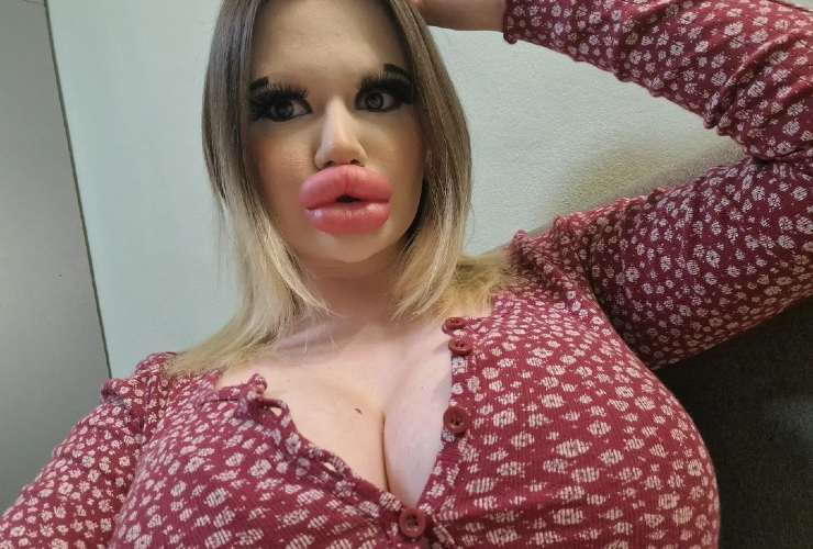 Donna spende migliaia di sterline per avere le labbra più grandi del mondo